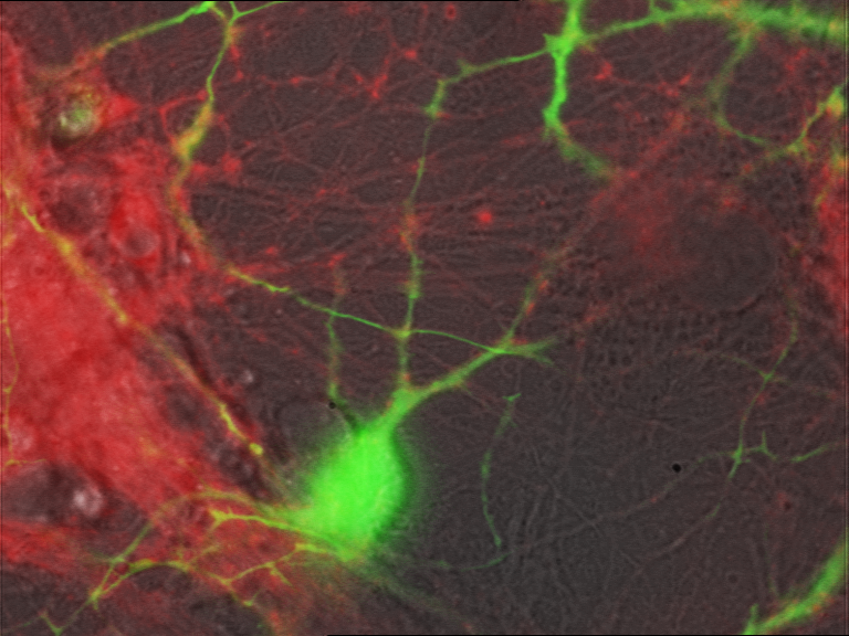 FM 4-64, GFP and brightfield image of a cerebellar culture